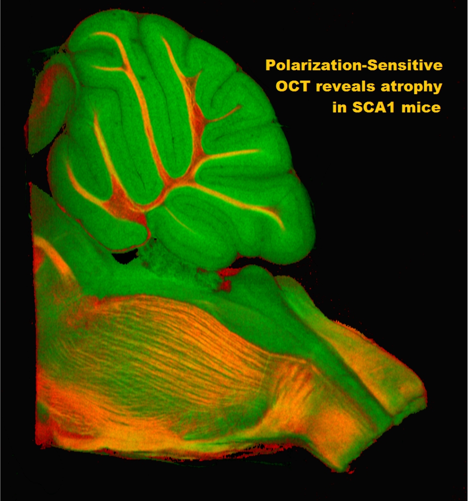 Polarization-Sensitive OCT reveals atrophy in SCA1 mice